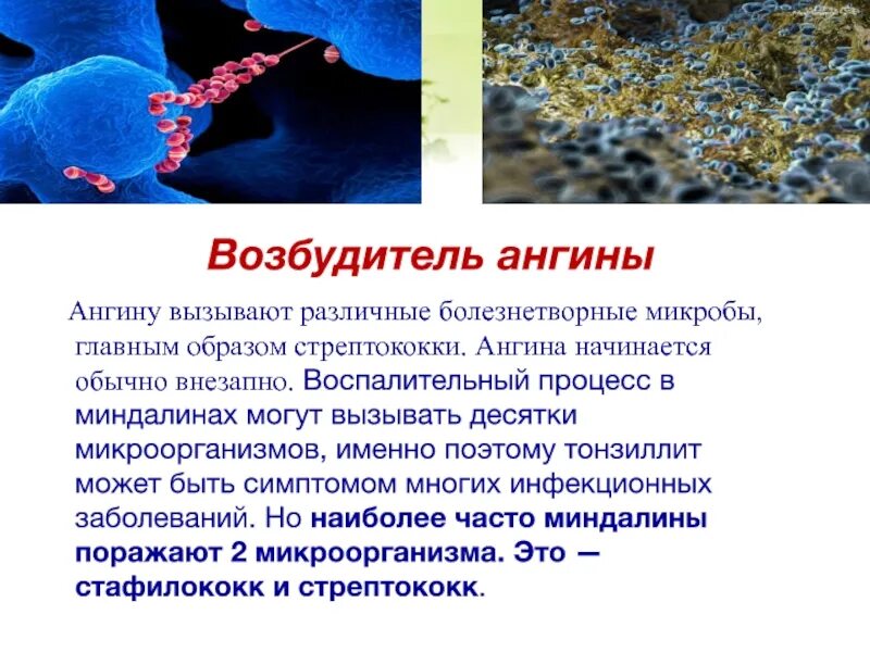 Тонзиллит вызывают бактерии. Возбудители тонзиллита бактерии. ангина бактерии возбудители стрептококки. бактерии вызывающие ангину. ангина возбудитель стрептококк.