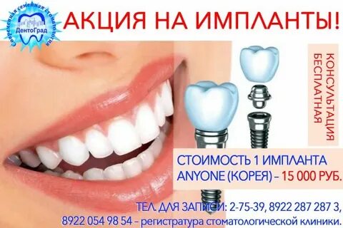 Импланты корея отзывы