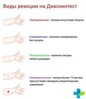 Прививка дст