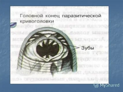 Головной конец