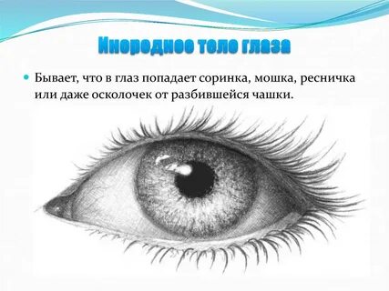 Что делать если в глаз попала соринка