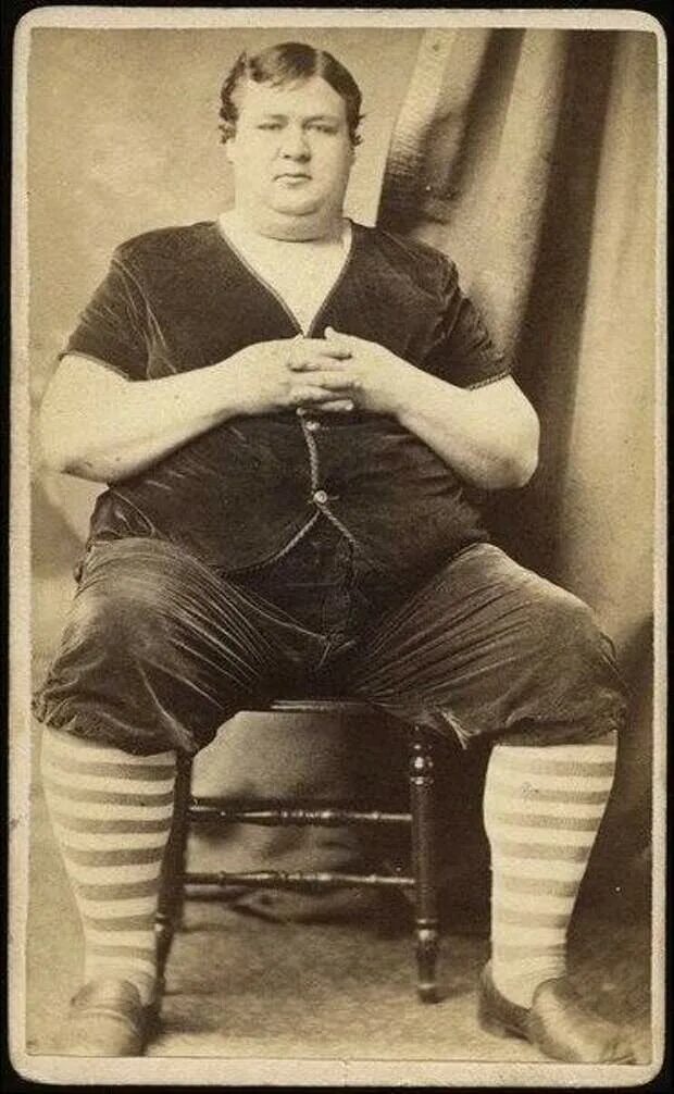 Самый толстый человек 19 века. Необычайно толстая