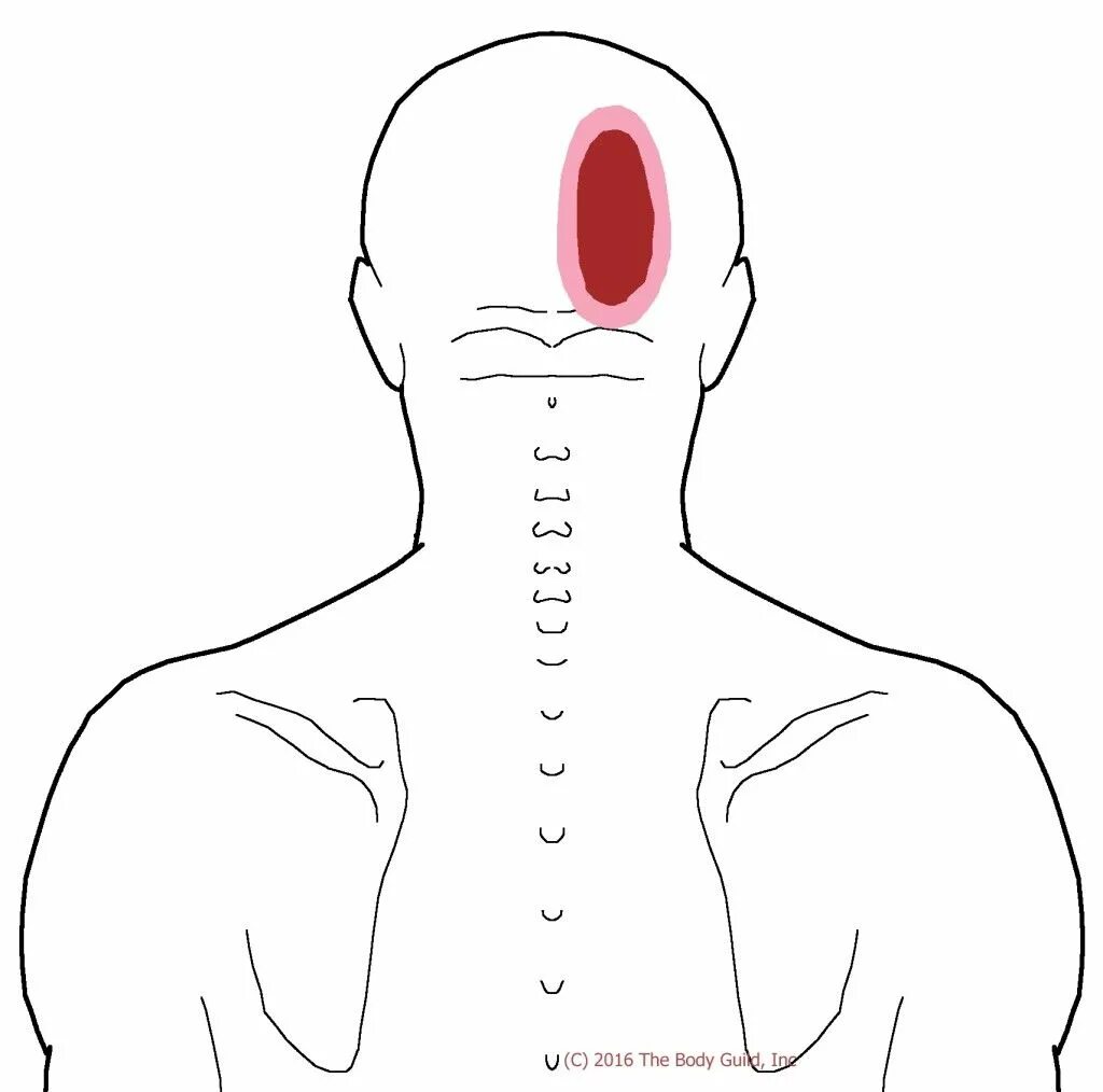 Сторона затылок. Болит затылок справа.