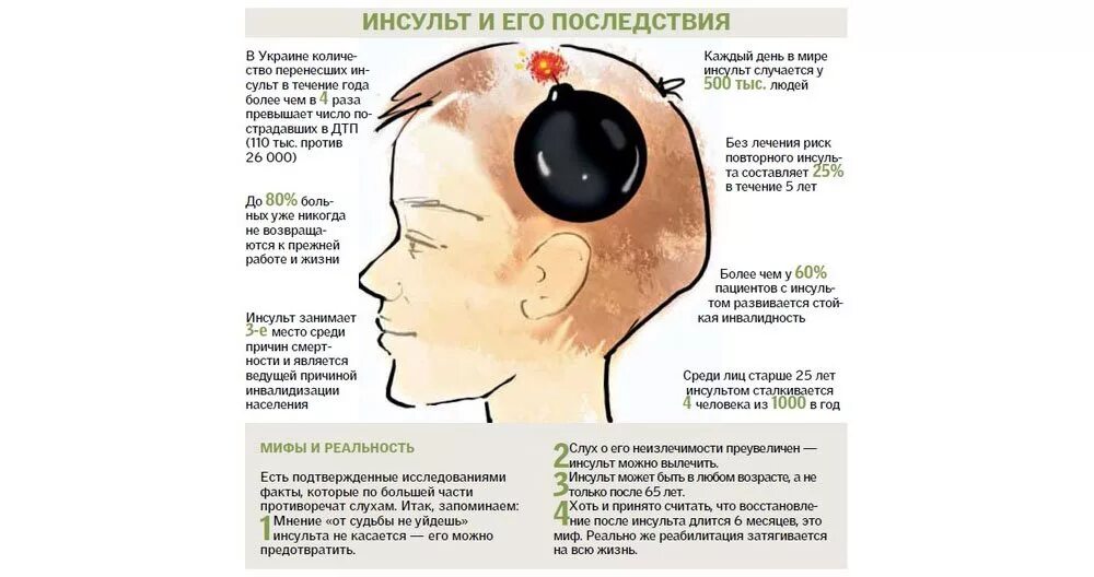 Инсульт парализация левой стороны. Болит голова. Инсульт мозга последствия. Головная боль локализация.