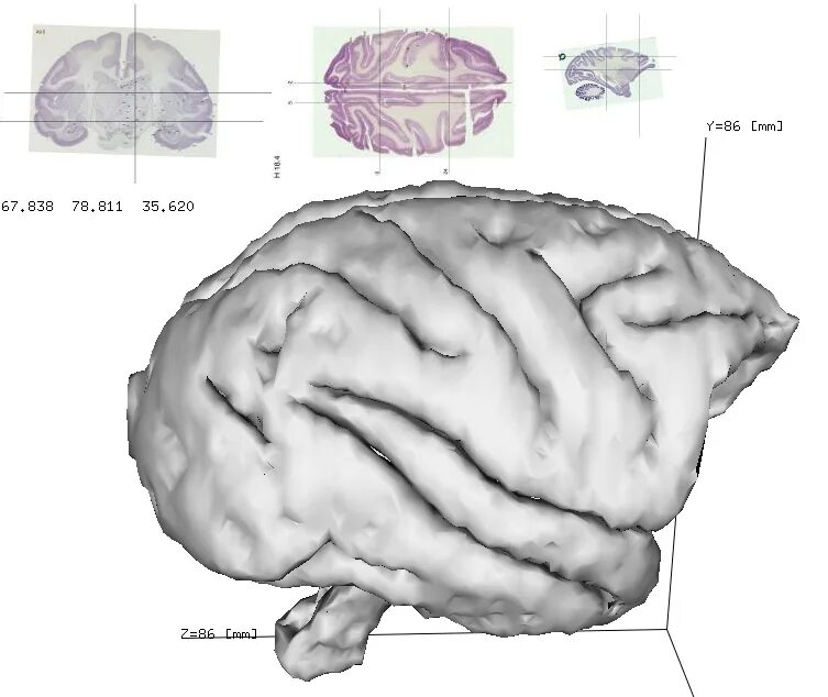 Brain Maps. Brain Maps арт. The Brain Maps в 16. Brain карта