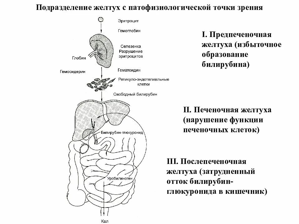 Печеночная желтуха билирубин. Печеночная желтуха билирубин