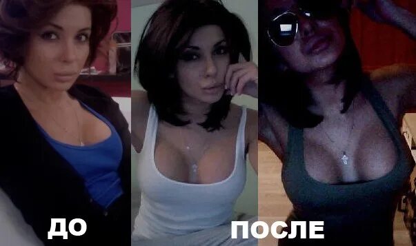 Как сделать идеальную грудь с помощью пластики