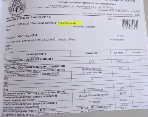 Ат к hcv. Антитела к гепатиту в норма. Анализ на антитела к гепатиту б. АТ анализ гепатите в. Анализ крови на антитела к гепатиту в.