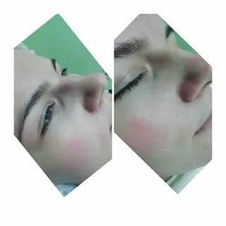 Чистка лица новосибирск