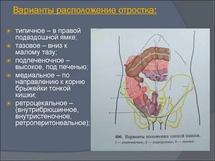 Полость аппендикса