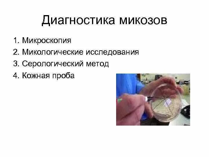 Методы микробиологического исследования микозов. Микробиологическая диагностика микозов. Метод диагностики микозов. Метод диагностики микозов. 3.