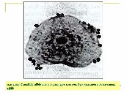 Буккальный эпителий что это