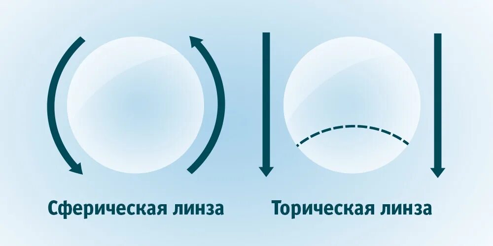 Торические линзы корректирующие астигматизм. Торические линзы при астигматизме. Сферическая и торическая контактная линза. Торические оптические линзы.