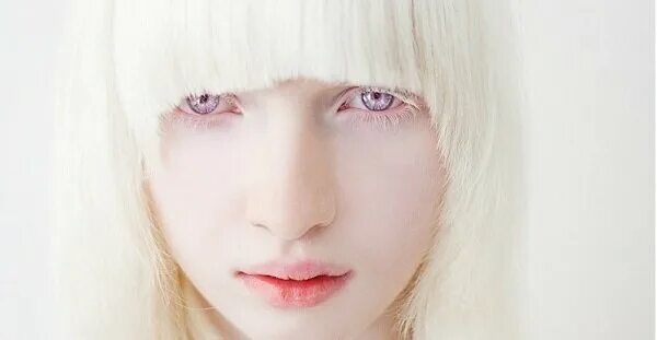 Brazilian photographer Gustavo Lacerda wanted to give albino people the chance t
