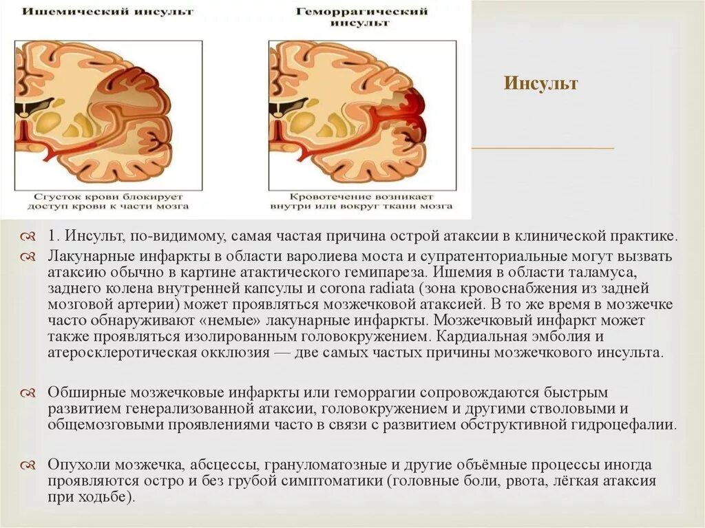 Поражение головного мозга последствия. Инсульт мозжечка симптомы. Инсульт мозжечка последствия. Инсульт в левой гемисфере мозжечка симптомы. Инсульт мозжечка головного мозга последствия.