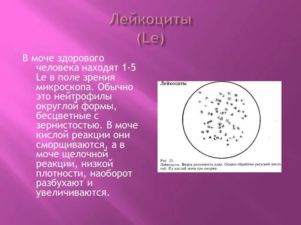 Лейкоциты в моче 1/2 поля зрения. Лейкоциты в поле зрения в моче. Лейкоциты в моче микроскопия осадка. Лейкоциты и эритроциты в моче под микроскопом.