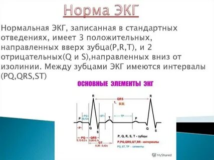 Показания экг норма