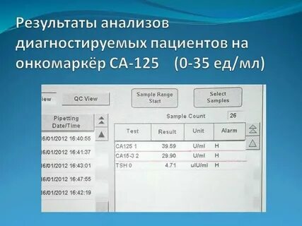 Са 125 натощак