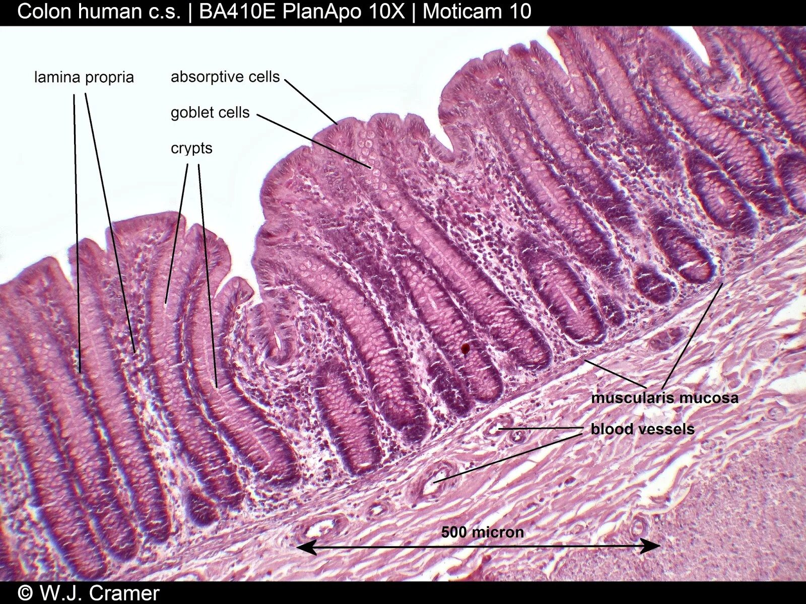 Angiectasia латынь