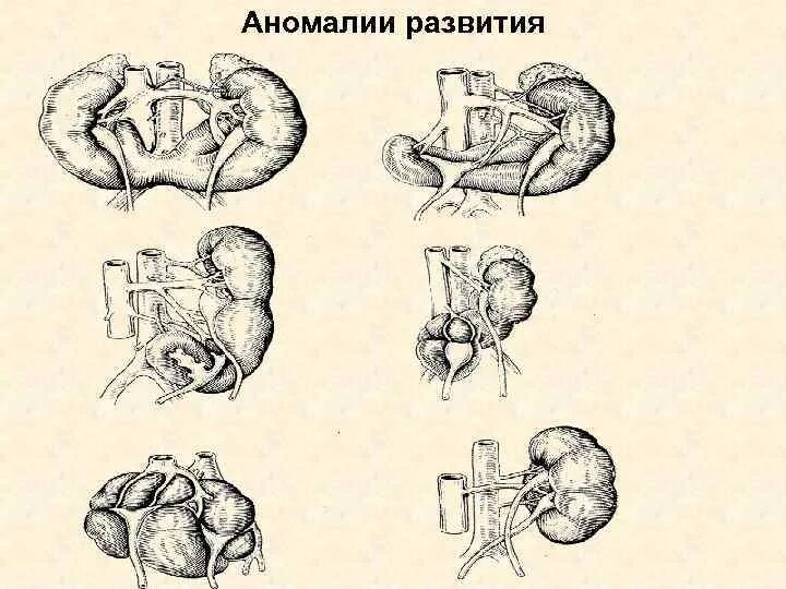 Аномалии развития называются. Врожденные пороки развития плода. Внутриутробные аномалии развития. Порок развития мальформация анатомия. Врожденные аномалии развития понятие.