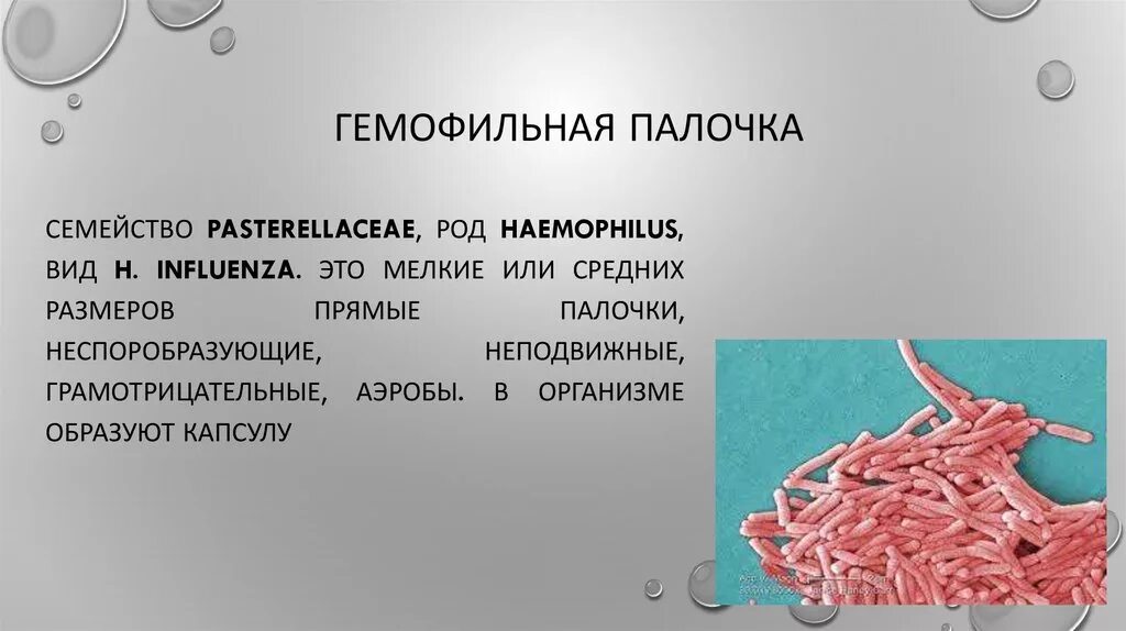 Бактерий палочка гемофильная палочка. Бактерии Haemophilus influenzae. Гемофильная палочка возбудитель. Haemophilus influenzae (гемофильная палочка). Haemophilus spp у мужчин