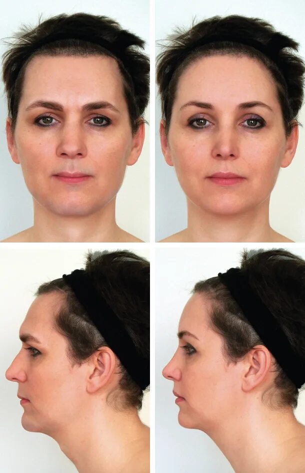 Язык пластики тела. Жетсы. Хейлопластика булхорн. Самые большие губы в мире кристина рэй. Красивый человеческий язык.