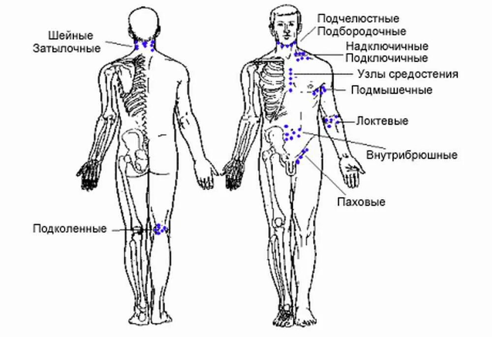 Лимфоузлы на теле женщины схема. Схема расположения лимфоузлов на теле человека. Где у человека находятся лимфоузлы схема. Лимфоузлы где находятся у мужчин. Лимфатические узлы на спине расположение.