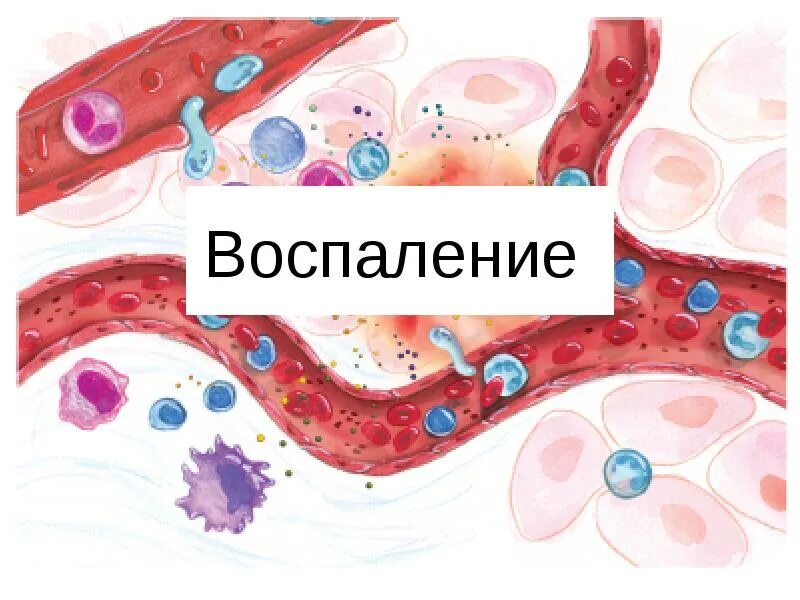 Чем грозит воспаление. Воспаление презентация. Воспалкнип.