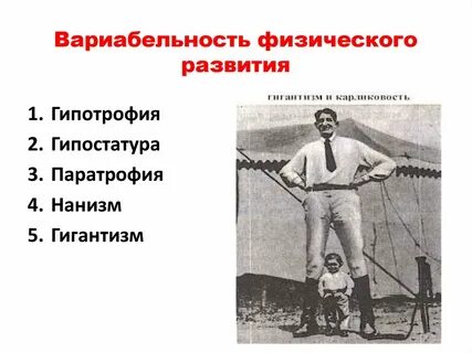 Гигантизм и карликовость
