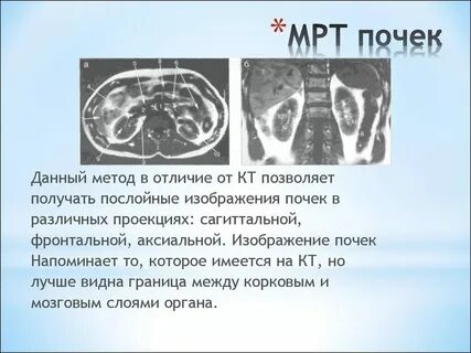Мрт почек подготовка к исследованию