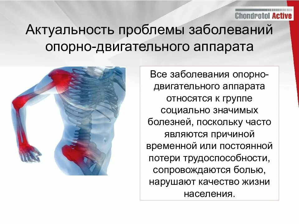 Нарушение функции двигательного аппарата. Памятка для пациентов с заболеваниями опорно-двигательного аппарата. заболевания опорно-двигательного аппарата актуальность проблемы. профилактика опорно двигательной системы. заболевания и травмы опорно двигательного аппарата.