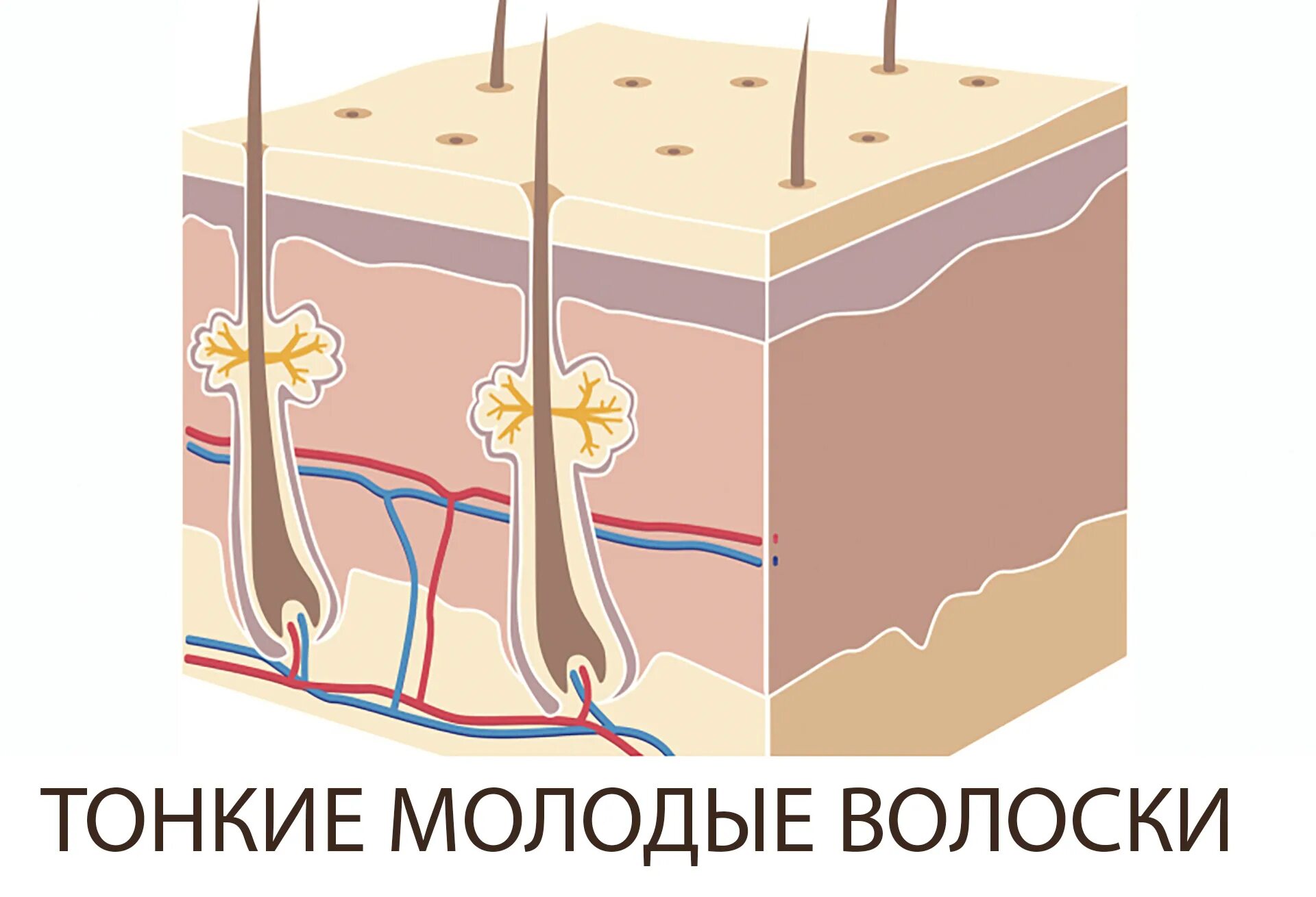 Лазерная эпиляция волосы выпадают через. Волосяной фолликул после лазерной эпиляции. эпиляция рисунок кожа. после лазера выпадают волосы. после лазера должны выпадать волосы.