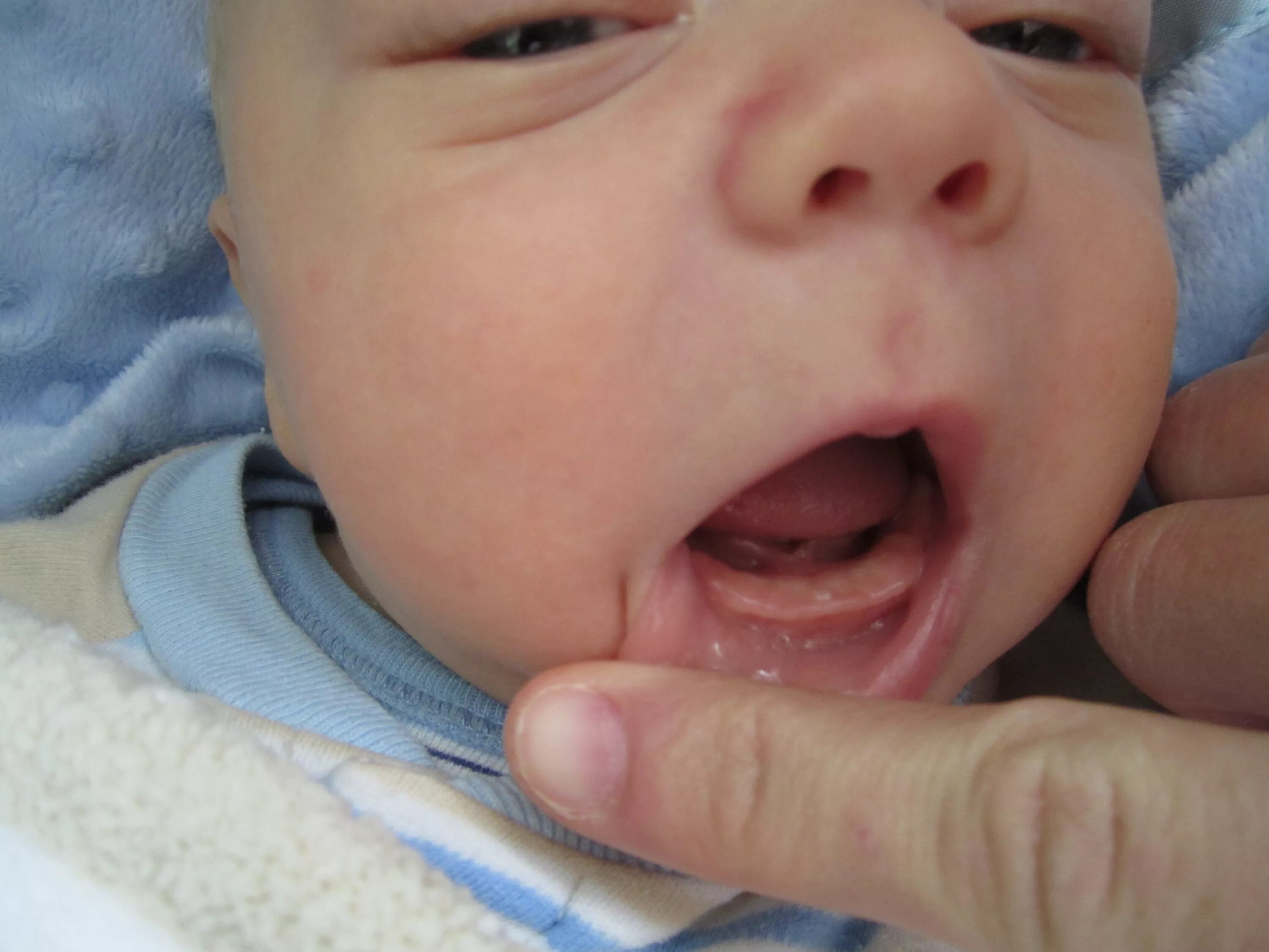 Ну вот теперь точно зуб! - 25 ответов форум Babyblog
