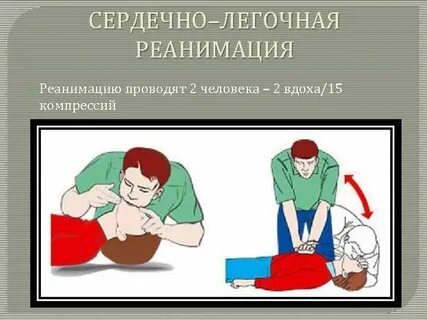 Время реанимации человека