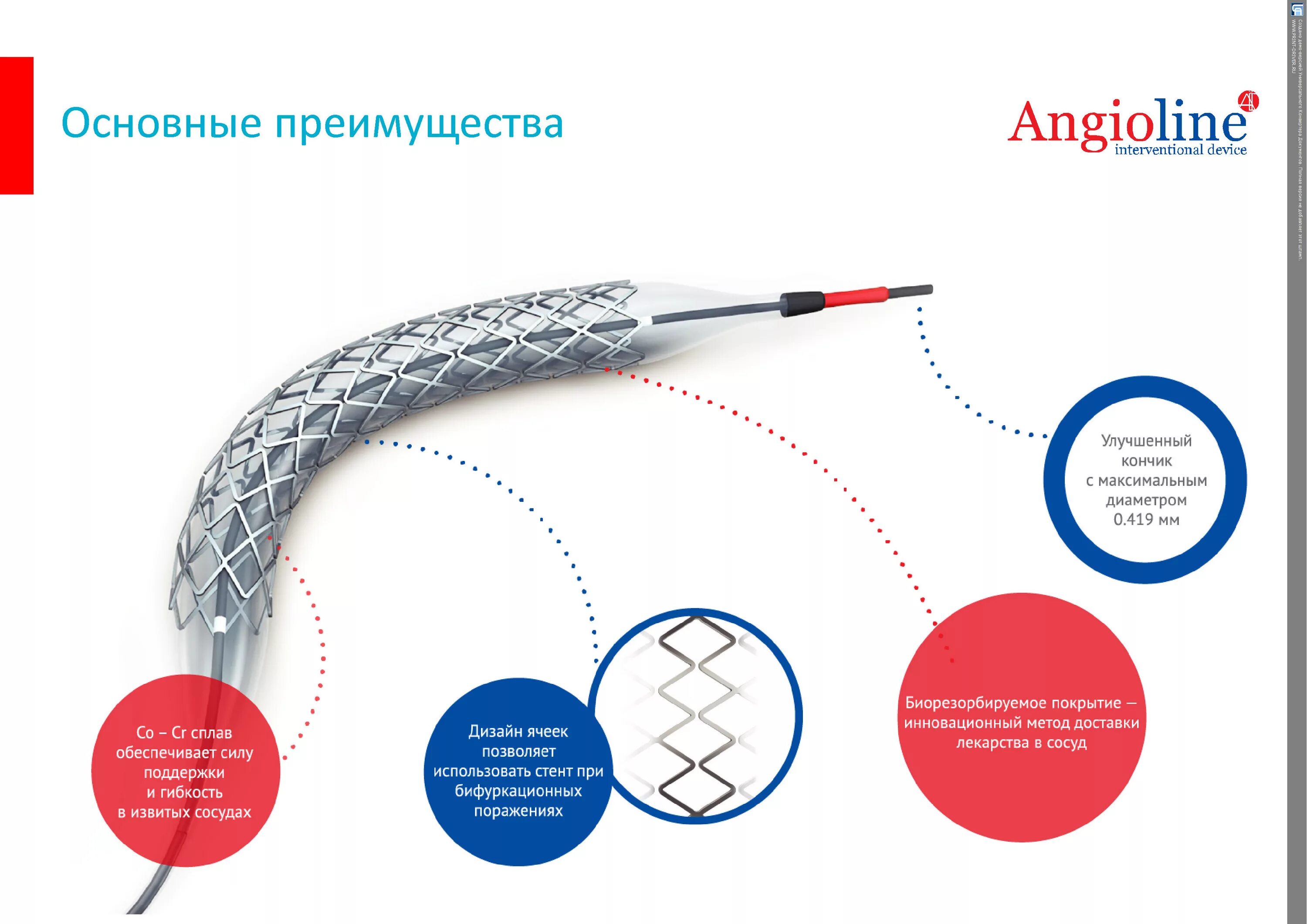 Лекарственный стент. Коронарный стент Калипсо. Стент Калипсо производитель. Коронарный стент Калипсо Calipso. Angioline стенты.