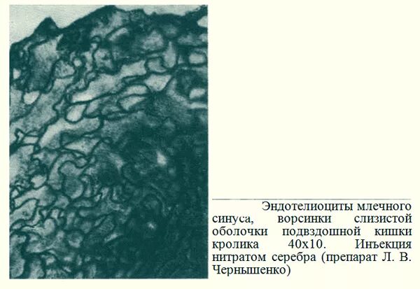 Млечные синусы ворсинок кишечника. Млечный синус в тонкой кишке. Строение ворсинки тонкой кишки Млечный синус. Эндотелиоциты фото.