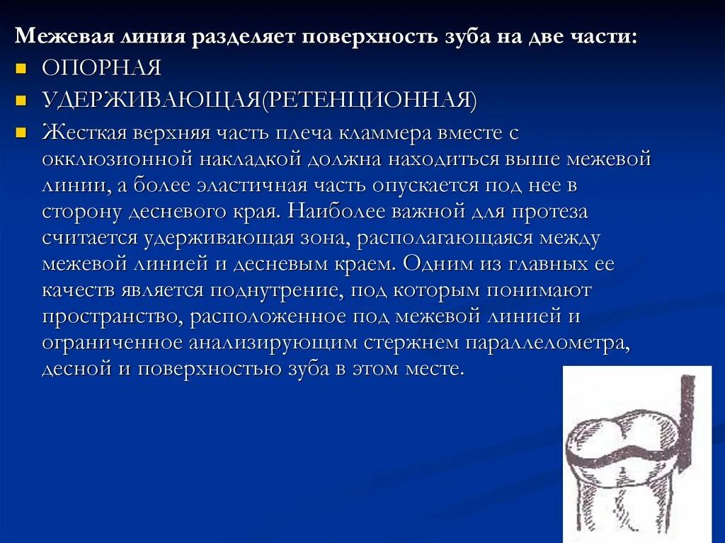 Разбивая поверхность. Ретенционная часть плеча опорно-удерживающего кламмера. Атипичная Межевая линия. Ретенционной части плеча кламмера. Опорно-удерживающие кламмеры.