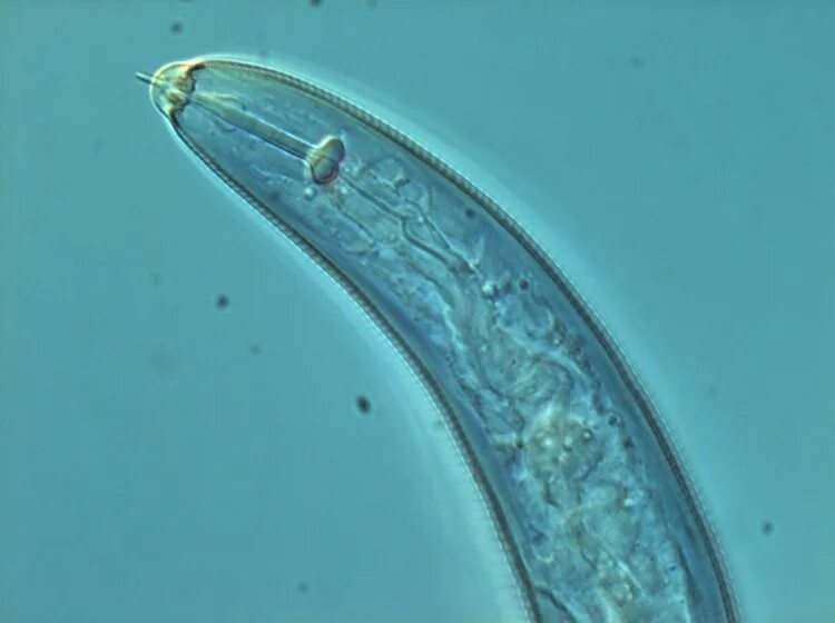 Черви покрыты кутикулой. Круглые черви (нематоды) микроскоп. Нематода микроскоп. Галловая нематода. Яйца нематод микроскоп.
