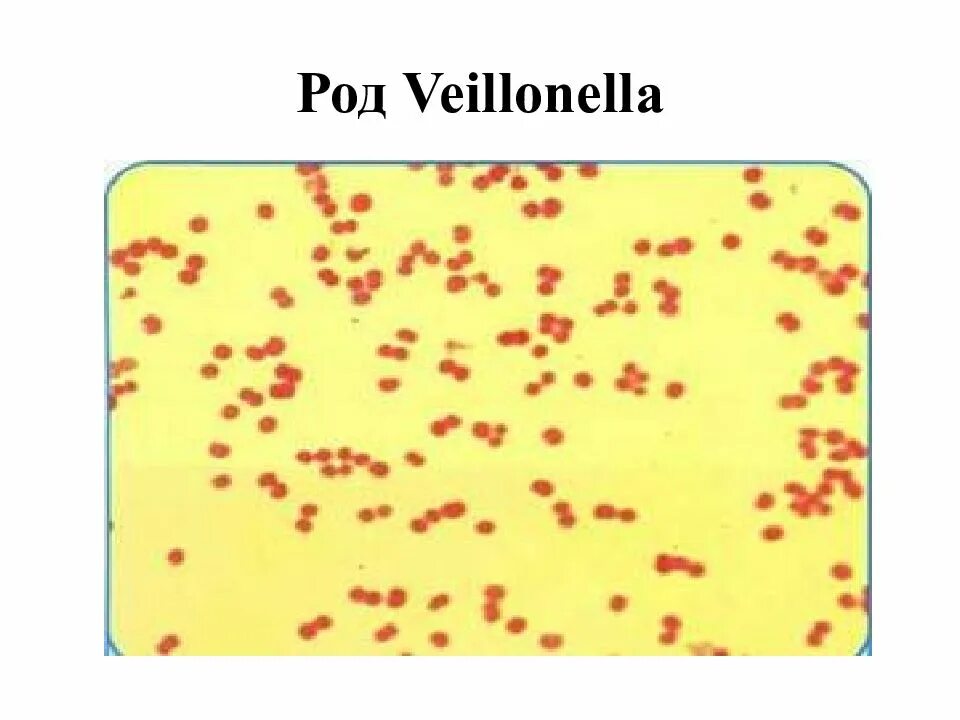 Peptostreptococcus. Вейлонелла микробиология. Вейлонеллы окраска по Граму. Вейлонеллы микробиология морфология.