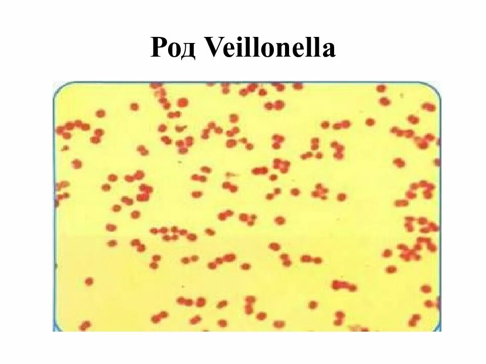 Вейлонелла микробиология. Вейлонеллы окраска по Граму. Вейлонеллы микробиология морфология.