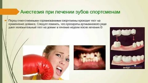 Лучшая анестезия при удалении зуба