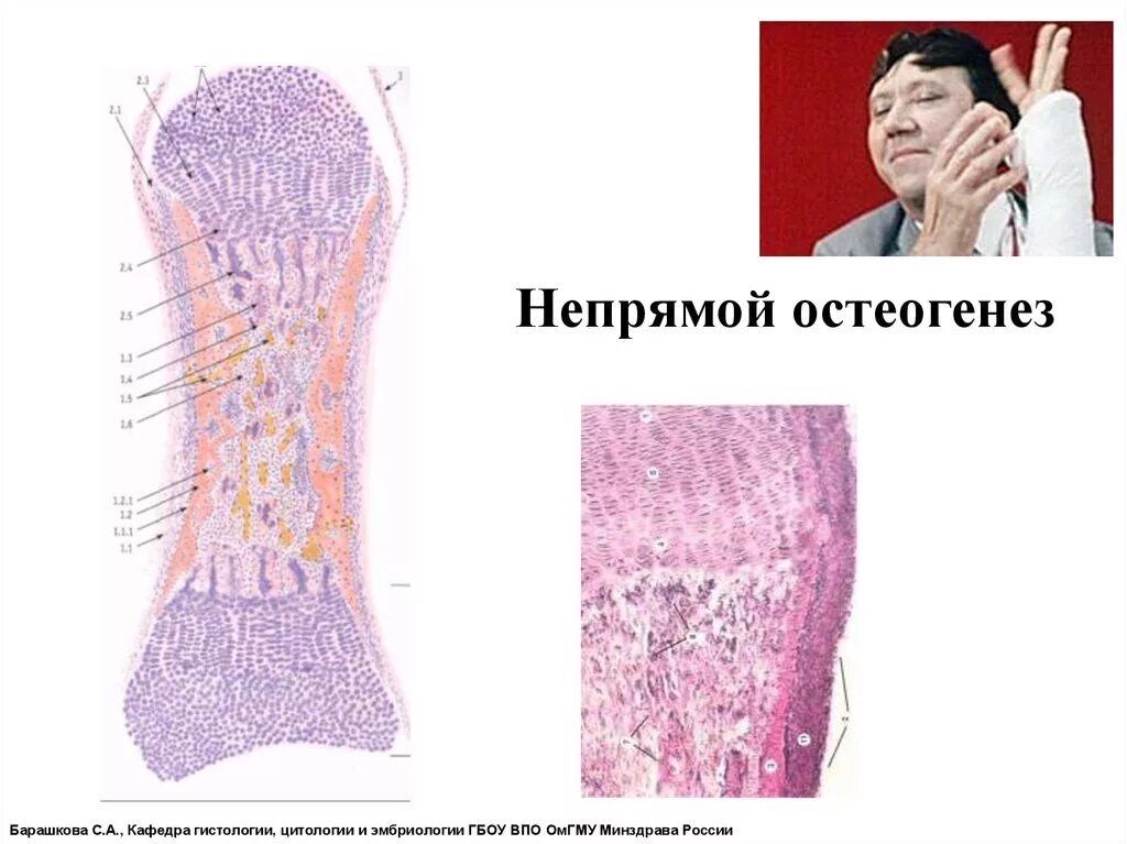 Прямой и непрямой остеогенез гистология. Прямой и непрямой остеогенез гистология