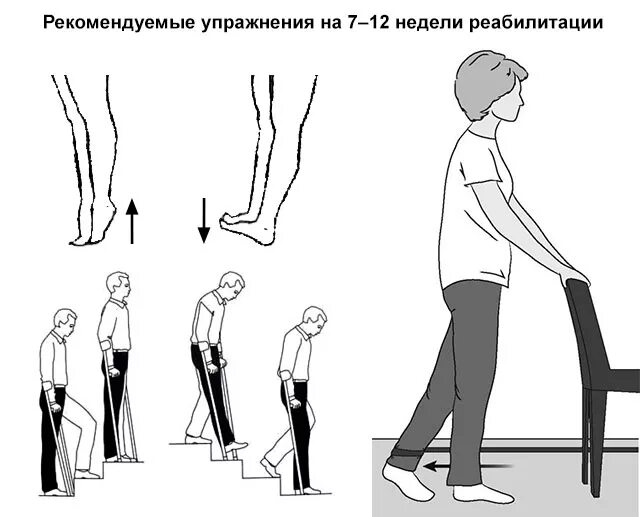 Гимнастика после операции эндопротезирования коленного сустава. Комплекс упражнений после эндопротезирования коленного сустава. Реабилитация после эндопротезирования коленного сустава упражнения. Лечебная физкультура после эндопротезирования коленного сустава. Эндопротезирование тазобедренного сустава упражнения после операции