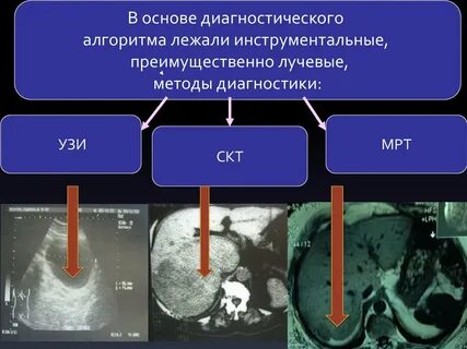 Вторичные очаги в печени