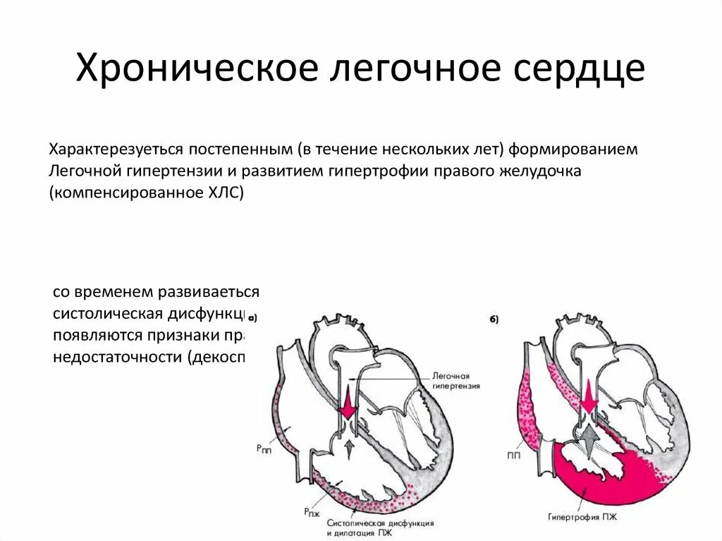 Хроническая легочно сердечная недостаточность. Механизмы формирования легочно-сердечной недостаточности. Синдром хронического легочного сердца. Легочная гипертензия и хроническое легочное сердце. Отделы сердца, которые гипертрофируются при легочном сердце.