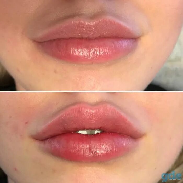 Форма губ бант. Форма губ бантиком. голливудский объем губ. круглая форма губ. округлая форма верхней губы.