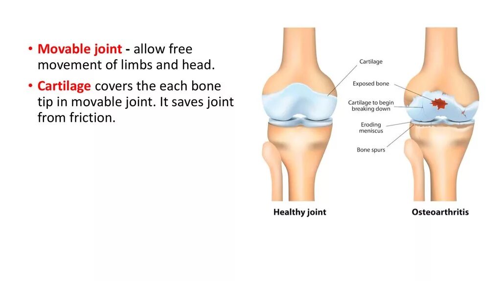 Moveable Joints. Semi-movable Joints. Movable. Linear movable Joints.