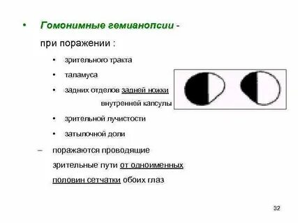 Поражение зрительных путей