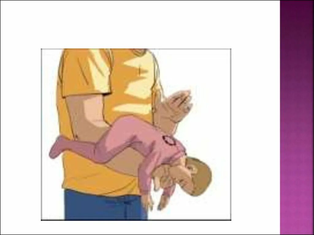 Инородные тела верхних дыхательных путей. Инородного тела в дыхательные пути недопустимо. Оказание первой помощи при инородном теле в дыхательных путях. Оказание дмп при инородном теле дыхательных путей. Первая помощь при попадании в дыхательные пути.