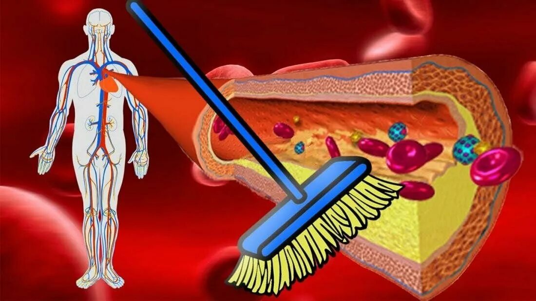Загрязненные кровеносные сосуды. Очистить кровеносные сосуды. Как очистить сосуды от холестериновых тромбов